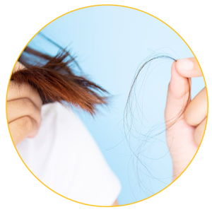 17 סיבות לנשירת שיער ושיער דליל אצל נשים